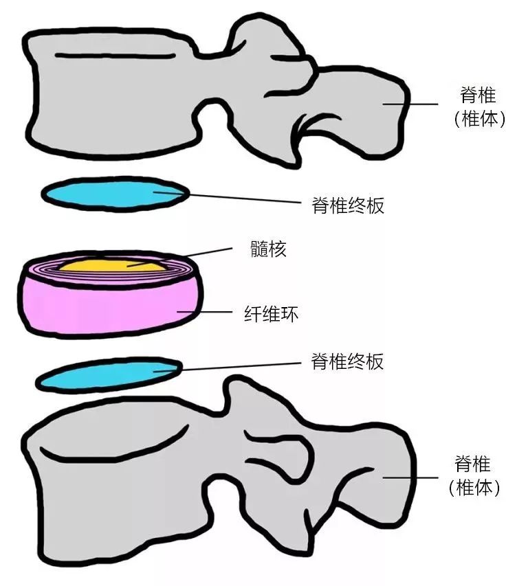 腰椎间盘突出是怎么发生的?如何预防?腰椎间盘突出的一定会有症状吗?