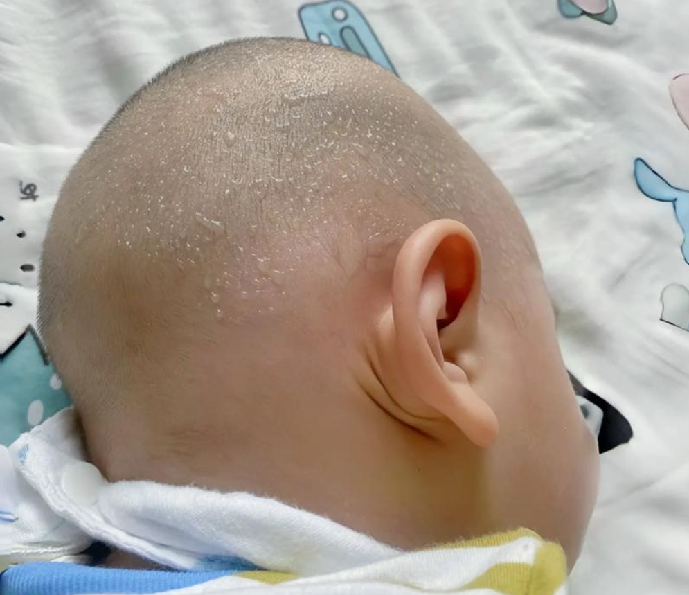 孩子晚上睡觉盗汗，可能是这4个原因，别盲目焦虑！