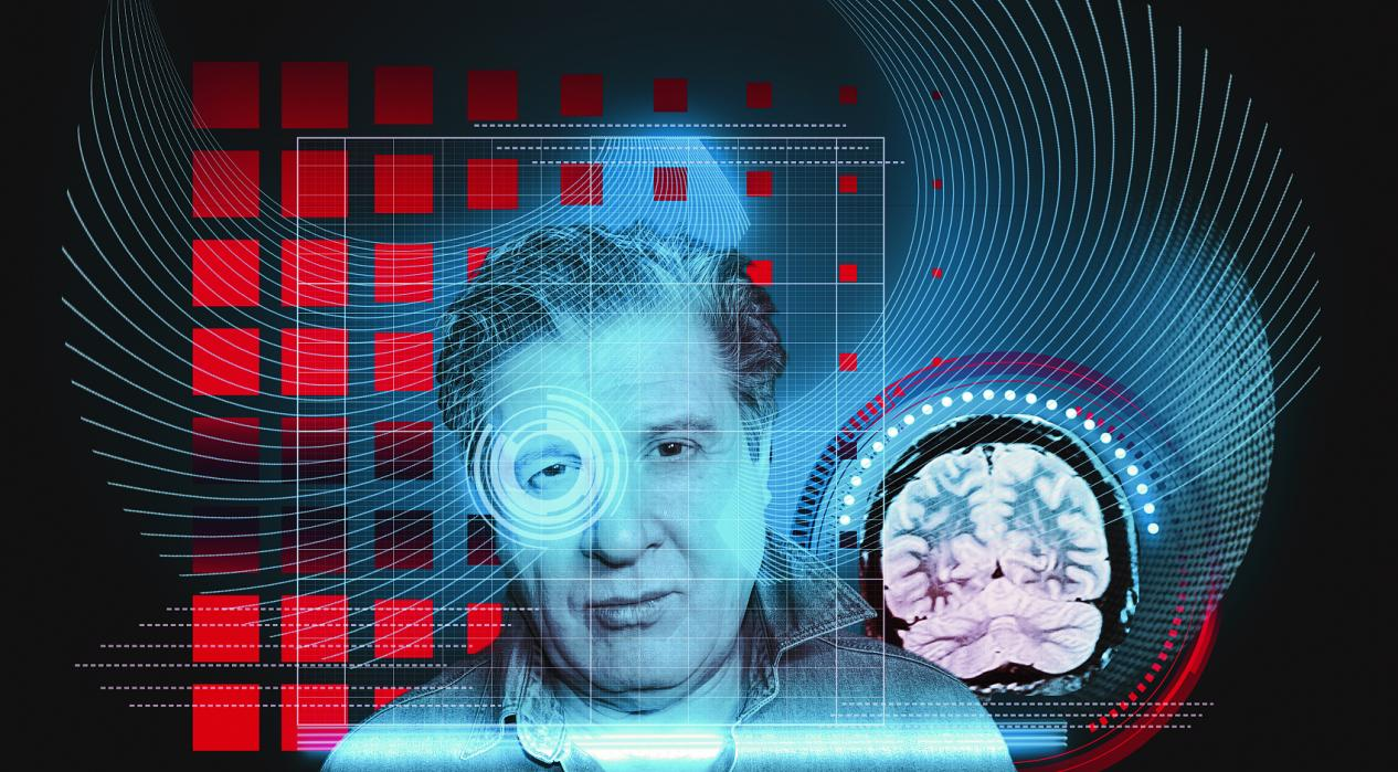 《柳叶刀》最新指南：阿尔兹海默症诊断标准发生巨变？