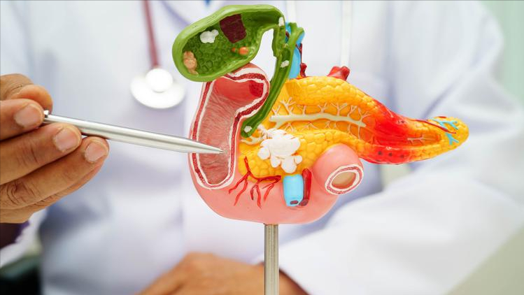 26岁女子胰腺炎去世，医生叹息：把4样当饭吃，胰腺再好也扛不住！