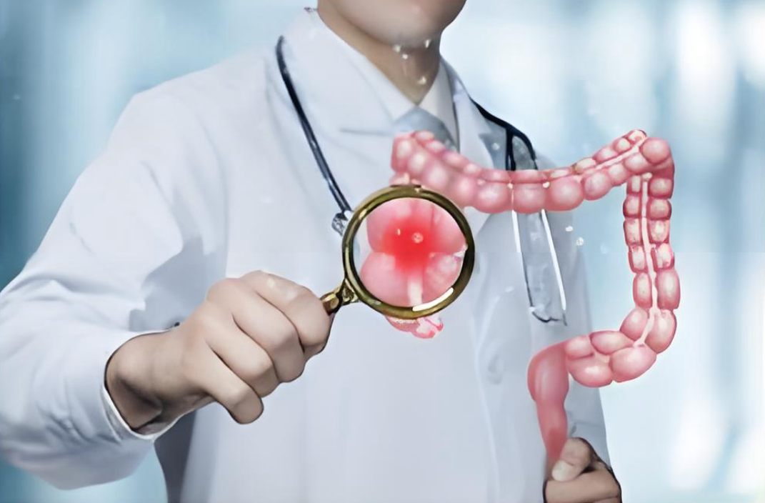 直肠癌最后都是怎么去世的？医生：多半是身体有4预警，没重视！