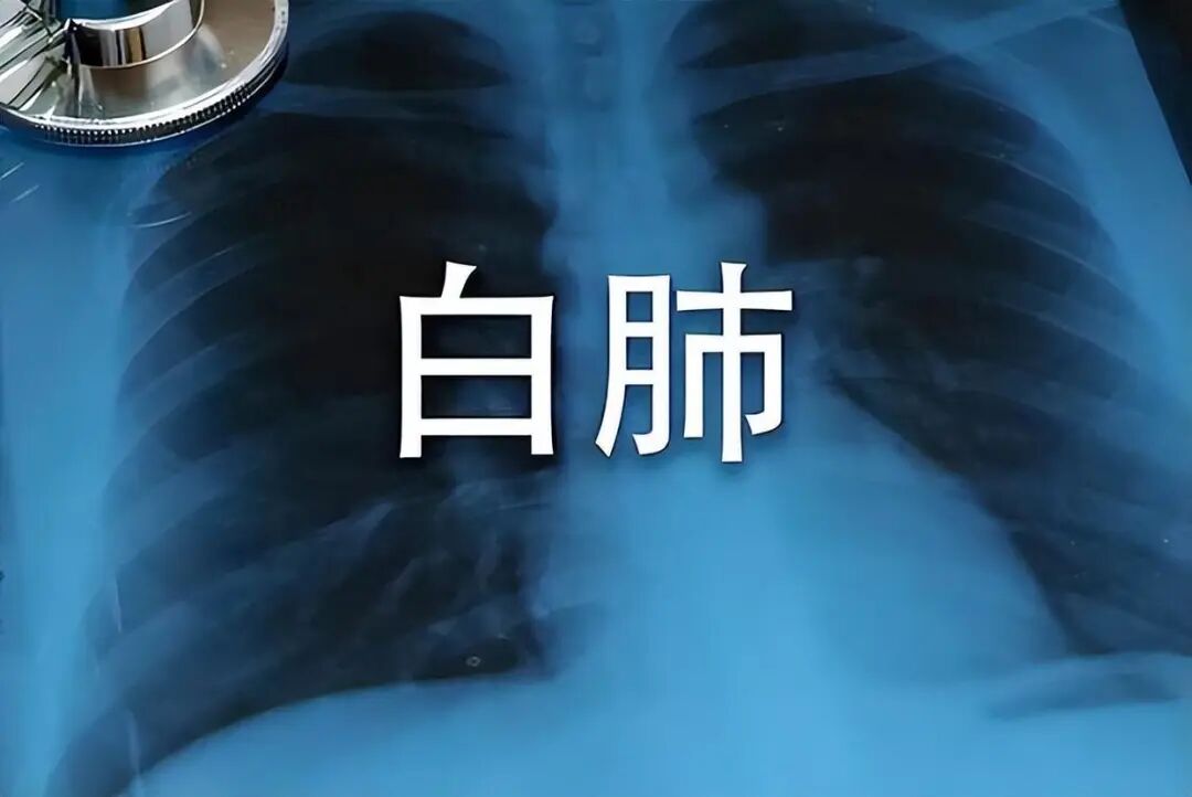 “白肺”早期不痛不痒？这3个表现千万别忽视！