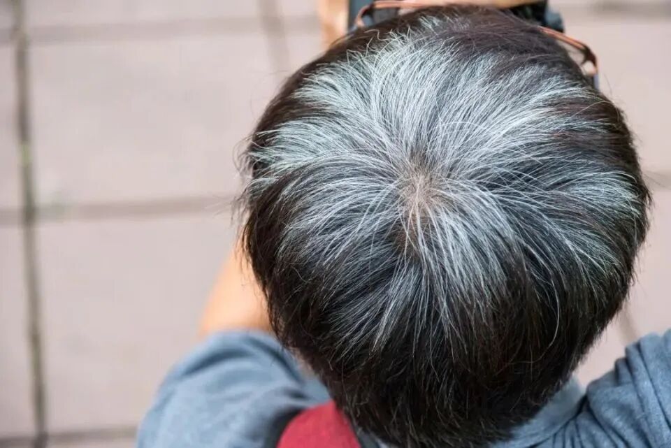 男性能活多久，看头发就知？若有这2异常，需要引起重视！