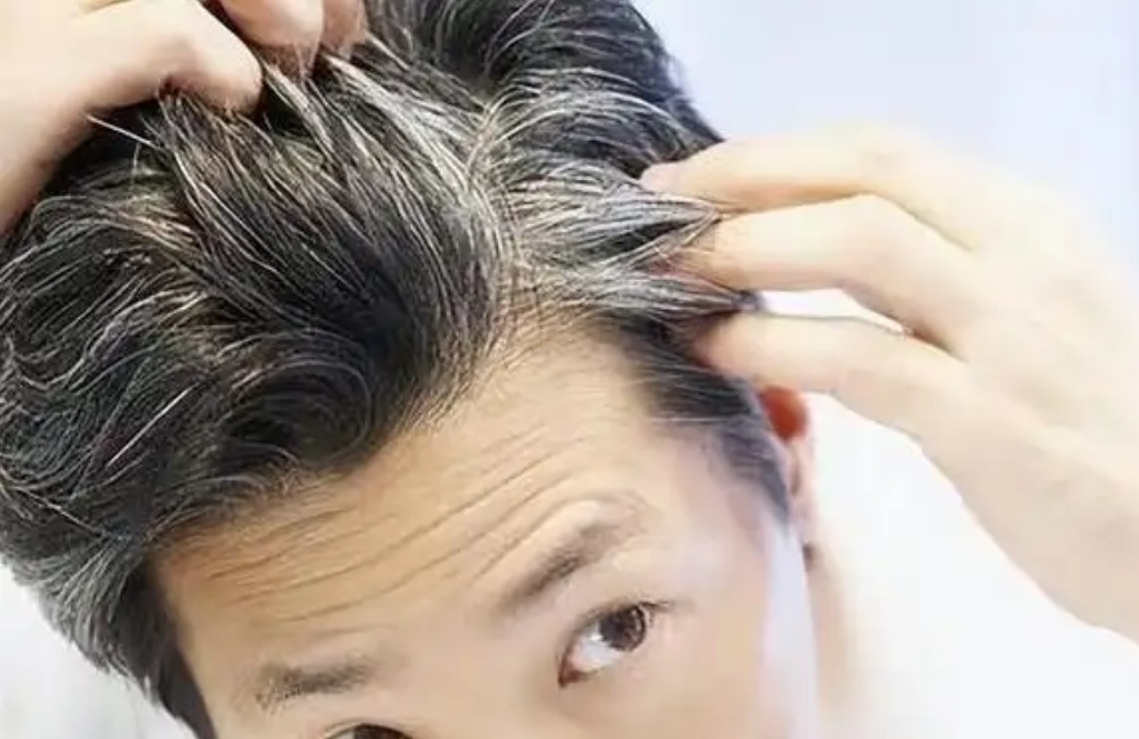 得不得癌症，一看头发就知道？医生：头发若有3种表现，及时就医！