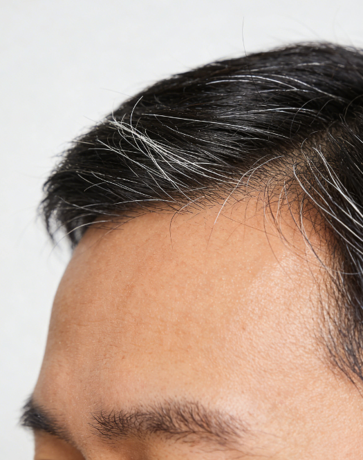 白头发拔一根长三根？麦向健康带你揭开真相！