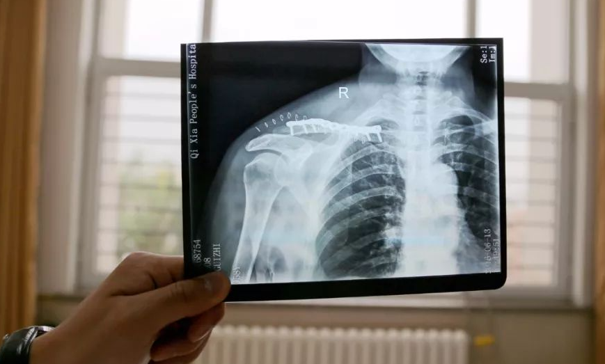 中医的望闻问切，为啥去到西医就直接要拍片？