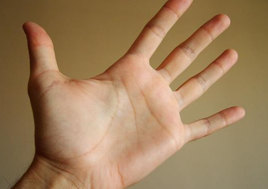 看手掌颜色，就能知健康？这些信号别忽视